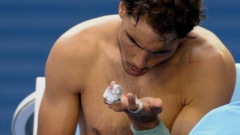 Herida complica participación de Nadal en el Abierto de Australia