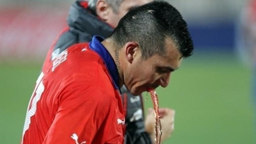 Gary Medel perdió un diente luego de recibir un codazo en duelo ante Perú