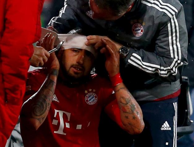 Arturo Vidal descarta partir del Bayern Munich: “Estoy en el mejor equipo del mundo”