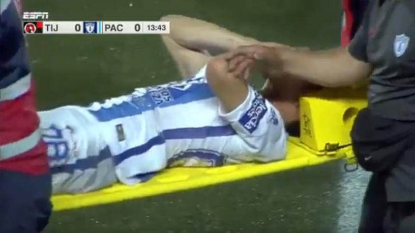 [FOTO] El terrible pisotón que dejó sangrando a un jugador y conmociona a México