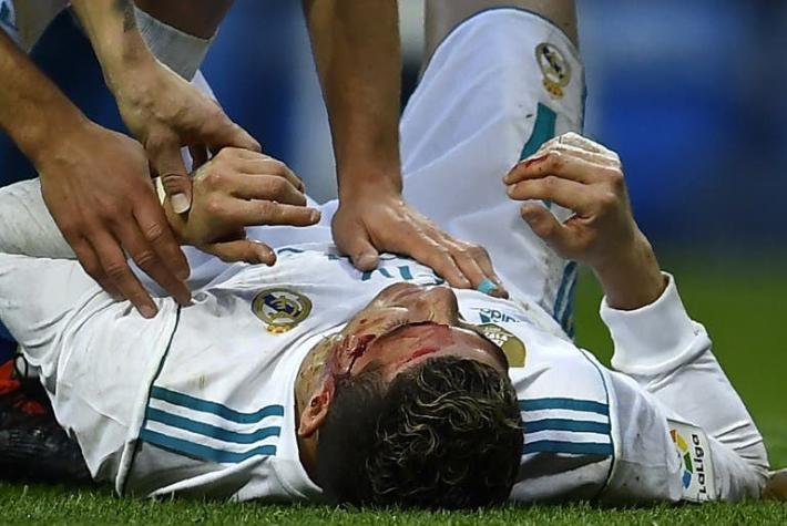 [VIDEO] Ver para creer: La vanidad de Cristiano, una asquerosidad monumental y un festejo doloroso.