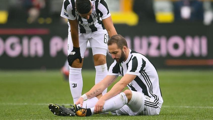 Gonzalo Higuaín espera volver para la revancha de Champions ante Tottenham