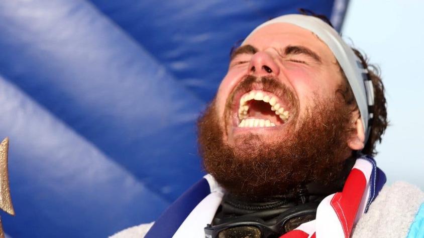 Los terribles efectos en el cuerpo de Ross Edgley tras nadar 157 días alrededor de Gran Bretaña