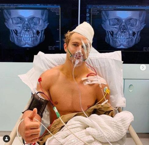 [VIDEO] Debutante de MMA sufrió un violento nocaut que le ocasionó ocho fracturas en el rostro