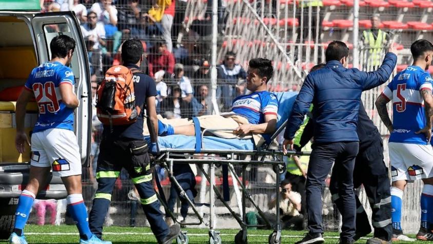Confirman fractura de tibia y peroné de Francisco "Gato" Silva