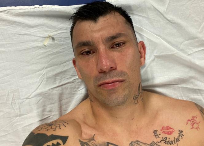 Entre lágrimas: El crudo descargo de Gary Medel tras lesionarse en duelo del Bologna
