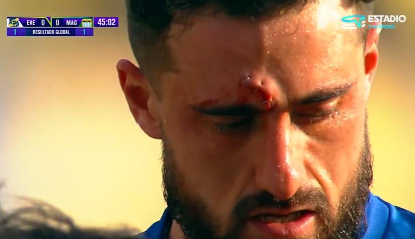 El portero terminó con corchetes en su frente: Así fue el choque entre Fernando De Paul y Felipe Flores en la Copa Chile