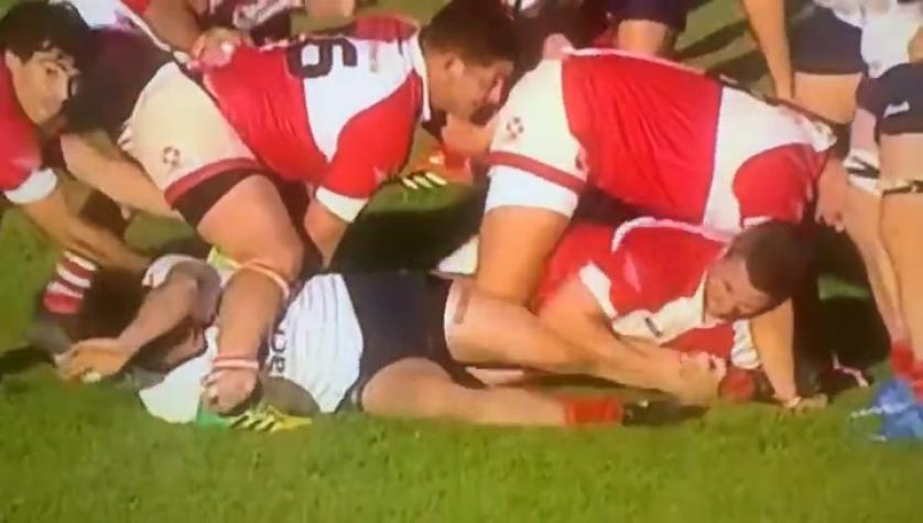 VIDEO | Jugador de rugby argentino provocó intencionalmente terrible lesión a su rival y se ganó el repudio del país