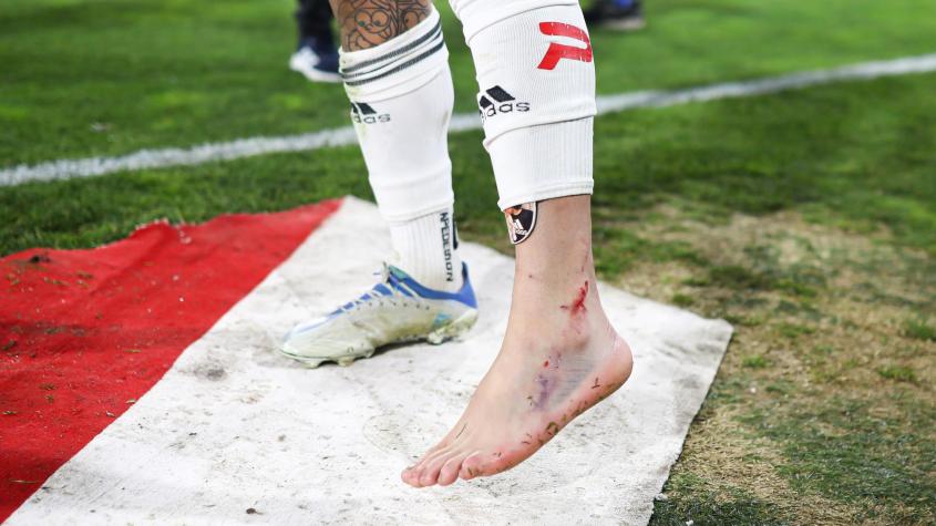 ¿Llegará al Superclásico? Así quedó el tobillo de Maximiliano Falcón tras salir lesionado ante Huachipato