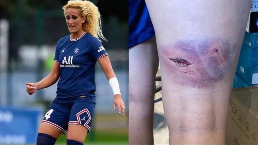 Escándalo en el PSG: Jugadora agredida supuestamente por compañera rompió el silencio y mostró fotos del brutal ataque