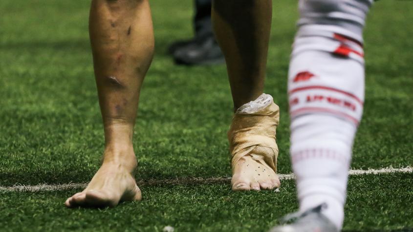 "Es inentendible": Jugador de Curicó Unido se quejó por el uso de canchas sintéticas en el fútbol chileno