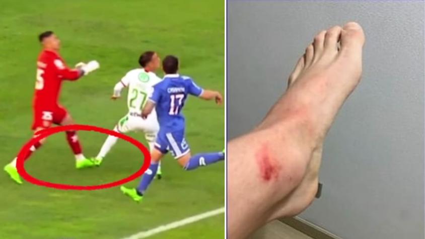 FOTOS| "Increíble": Cristóbal Campos realizó duros descargos contra el arbitraje y mostró cómo quedó su tobillo tras derrota de la U