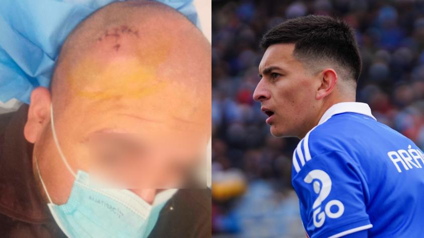"No me cuesta nada matar a un hue...": denuncian violenta y brutal agresión de un futbolista de la U contra un guardia