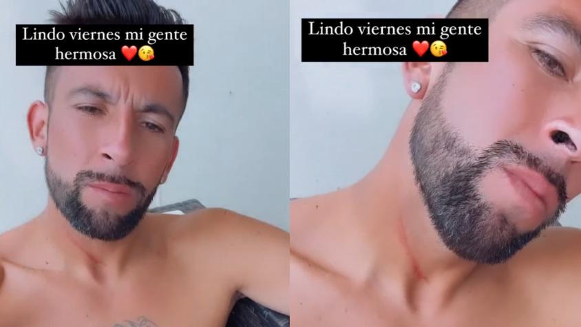 "Tenía las uñas largas": Mauricio Isla mostró en redes sociales un rasguño que le dejaron en el cuello