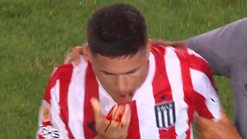 ¡No cobraron ni falta! El brutal codazo de ex Colo Colo que le voló tres dientes a un rival en Argentina