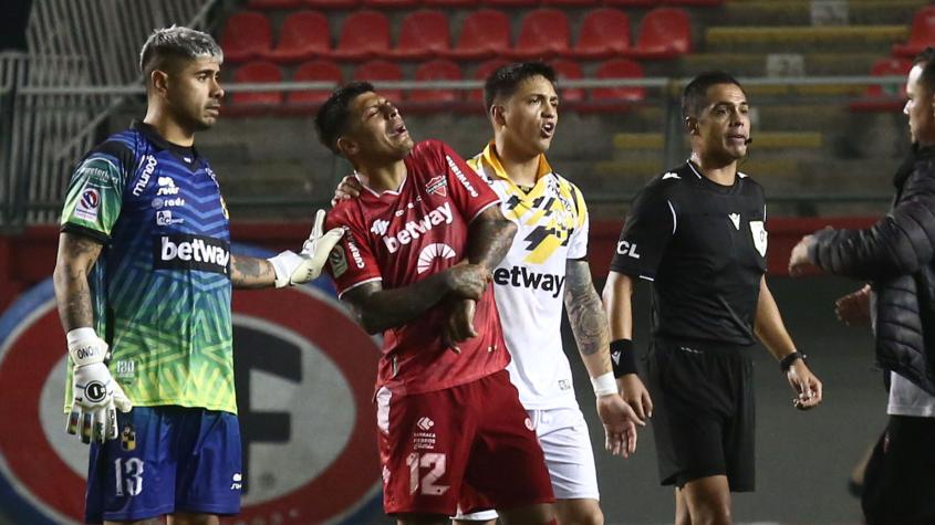 ¡Imágenes sensibles! Patricio Rubio sufrió una escalofriante lesión en la nueva derrota de Ñublense