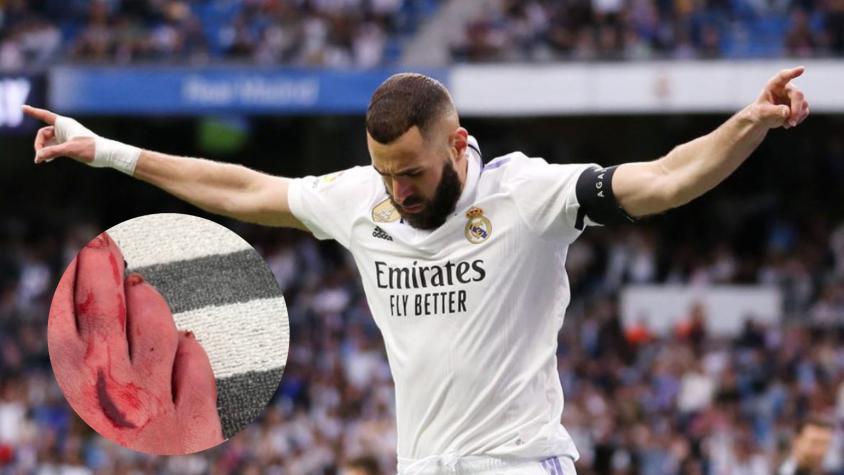 Pie Karim Benzema