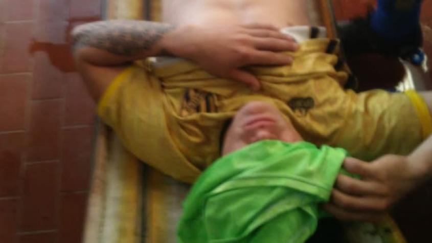 Repudiable agresión en el fútbol argentino: Hincha le quemó la cara a jugador con agua hirviendo