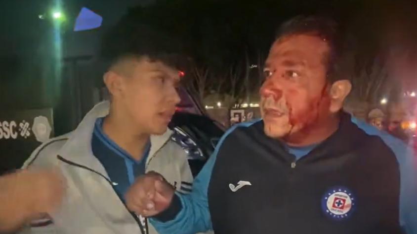 Hincha de Cruz Azul denunció agresión policial - Crédito: Captura.