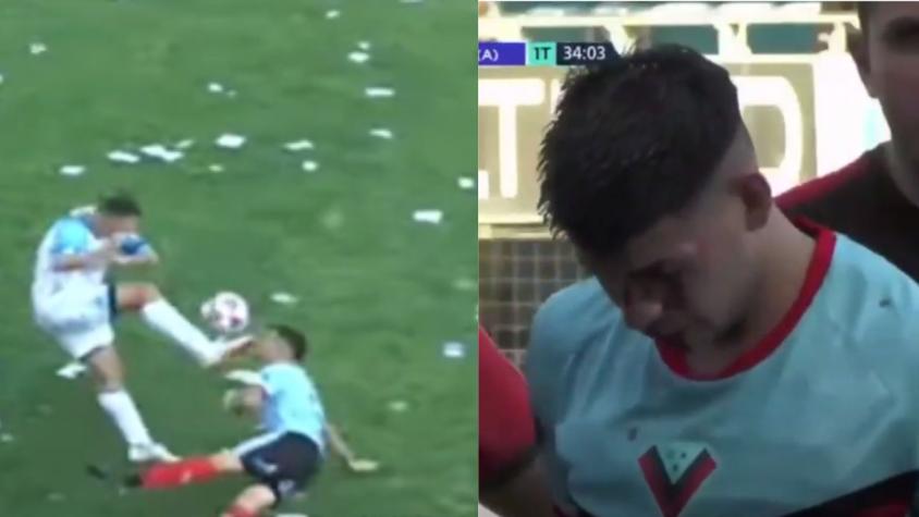 ¡Le fracturó el rostro! Claudio Bieler protagonizó violenta jugada en el Ascenso argentino