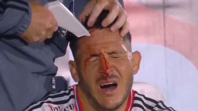 Noche para el olvido: La escalofriante imagen de Ramiro González que inquieta a Colo Colo