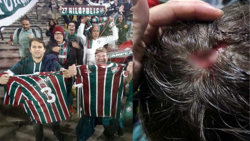 Fanático de Fluminense denuncia repudiable agresión de hinchas de Colo Colo