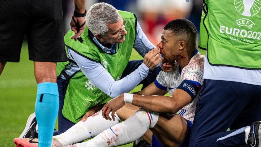 Kylian Mbappé sufrió golpe en la nariz - Créditos: @TyCSports