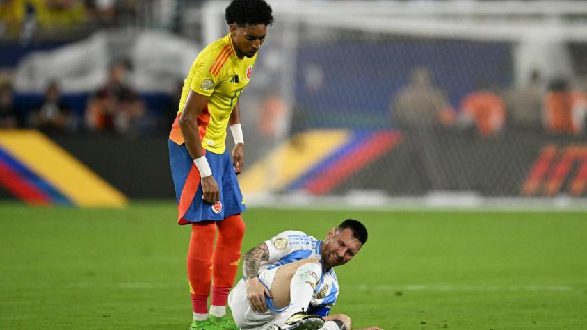 ¡Impactante! Así quedó el tobillo de Lionel Messi tras lesionarse en la final de la Copa América