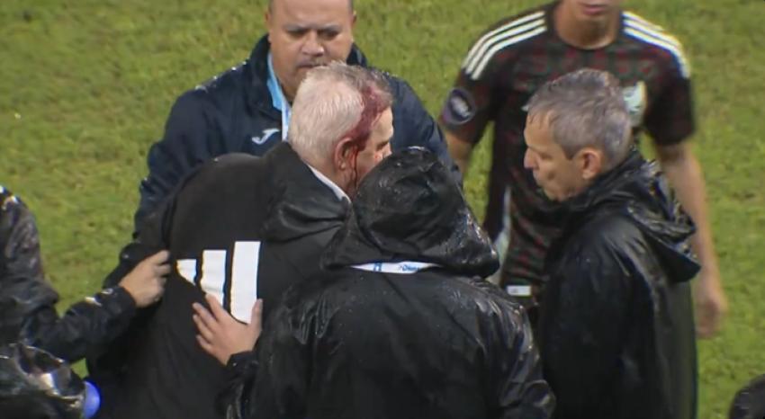DT de México fue agredido luego de perder con Honduras y se retiró del estadio ensangrentado